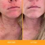 اسکاین تامین هیرتامین HAIRtamin SKINTAMIN - تصویر 5